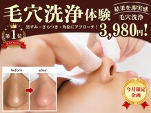 フォンターナ(Fontana)