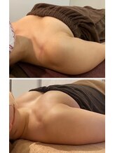 ラビス(RAVIS)/30代☆デコルテふっくらUP