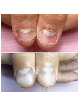 イリスネイル(IRIS NAIL)/