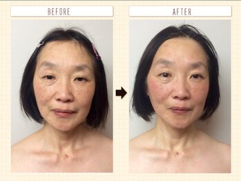 ディグニータココ 自由が丘(DIGNITA coco)/☆before after☆