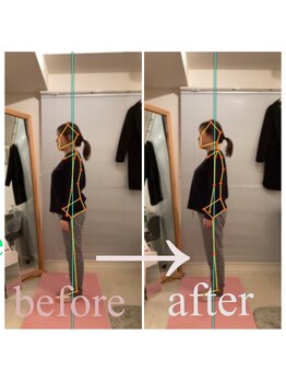 東京G整体/姿勢矯正ビフォーアフター◎