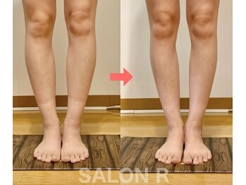 サロンアール(SALON R)/スリムな脚もさらにスラッと♪