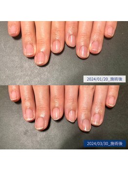 ブラン(blanc)/13.自爪育成