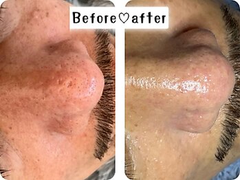 エムエー(MA)/ブラックピール