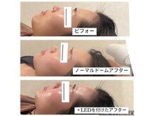 レイール(Reir)の雰囲気（翌日の肌質の変化に感動！）
