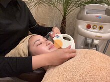 ドルチェ(Dolce)/お顔脱毛☆