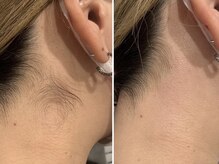 アインユウ 池袋店(AINYUU)/うなじワックス