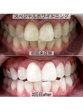 ヤット 森ノ宮(yatto.)/40代女性