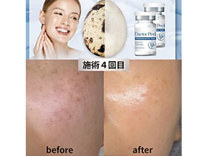 ケーブロッサムビューティーサロン(K Blossom Beauty Salon)の写真