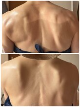 ジフィー(Gify)/筋膜リリースカッターTotal