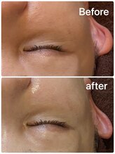 ヴィヴィアン 豊橋店(Vivian)/うるツヤ肌も超音波ケアで♪