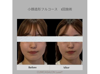 リュクシー(LuxeY)の写真