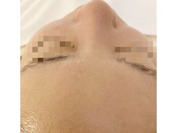 ゴールド 栄店(GOLD)/【2】ツルピカ美肌に○*゜