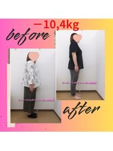 スーパースリムダイエット茅ヶ崎 茅ヶ崎整体院/3ヵ月－10,4ｋｇ減ダイエット♪