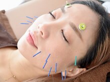 エミ(emi)の雰囲気（【鍼灸/美容鍼/頭皮鍼】自律神経の乱れを整え不調を改善◎）