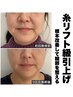 人気No.2【初回】小顔矯正＋リフトアップ機器施術＋筋膜リリース＋全身矯正