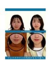 ハリラボ 仙台上杉店(hari Lab.)/【お客様の声】