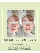 ソワナ(soina)/【神楽坂駅/フェイシャル/毛穴】