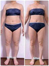 サロン アモル(salon amor)/インディバで全身痩身コース