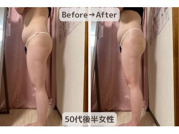 ピーチ(Peach)/骨盤矯正×ダイエット×美尻