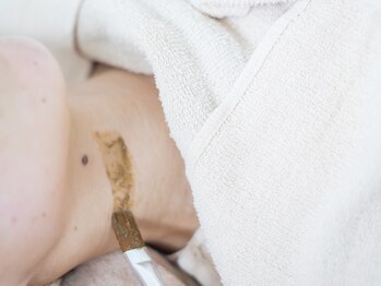 アーキ(ARCHI)/次世代ハーブピーリング