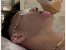 ボニータ(BONITA)/メンズ髭脱毛