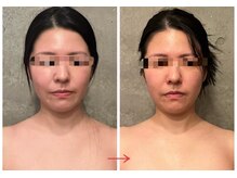 ビノワ(Binowa)/くすみが取れました★