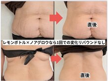 リアリア(LEALEA)/レモンボトル×ノアグロウ