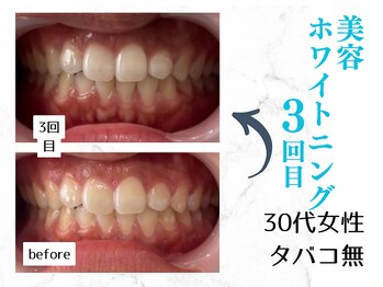 ルカノン(le canon)/素敵な花嫁になりました(*^-^*)