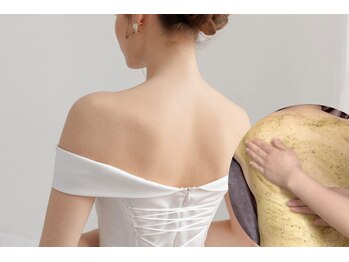 ブリス 渋谷駅前(BliSS)/ドレスの似合う背中美人に♪