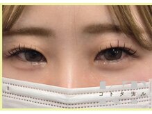 コトタリル/LEDマツエク