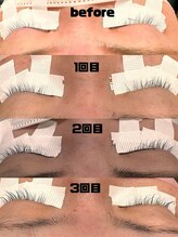 シュピネ(Choupinet)/◯d-max効果◯