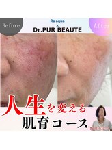 エステティックサロン ラ アクア(ra aqua)/肌が変われば人生が変わる！