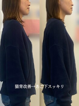 レディースカイロプラクティックカーム(calm)の写真/そのたるみ、顔じゃなく“姿勢”が原因です！

