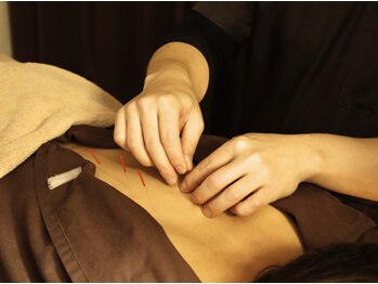 ホグ レール 東林間の写真/全身のバランスを見ながら辛いところにアプローチ!!ツボを的確に捉える全身鍼でスッキリ軽くなる体感を☆