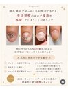 【爪先に負担のかかる動作】