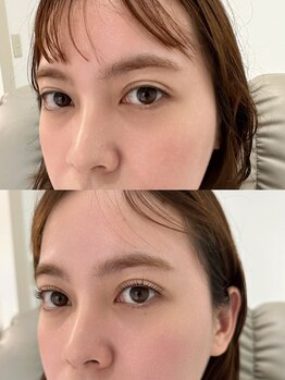 ユヒ(YUHI.)/まつげパーマ