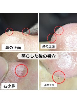 美鼻ラボ 押上 曳舟/リアルなウニョウニョ見せます!