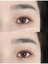 アミーラ(Amira)/フラットラッシュ