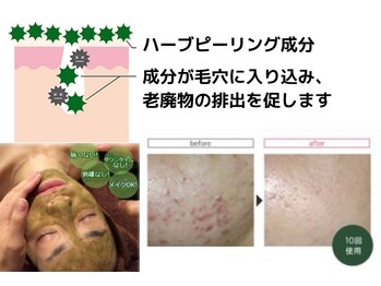 カラーリリー アンド ユン(Calla lily & yun)/剥離しないハーブピーリング