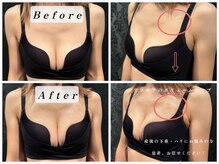 エステティックサロン パヒューム(Esthetic Salon Perfume)/授乳後でも自信が持てるバストへ