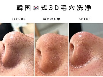 コンフィ(Comfy)/韓国式3D毛穴洗浄