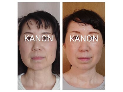 カノン(KANON)の写真