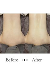 リラ 郡山店(Lilas)/肩甲骨を正しい位置に！