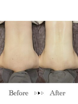 リラ 郡山店(Lilas)/肩甲骨を正しい位置に！