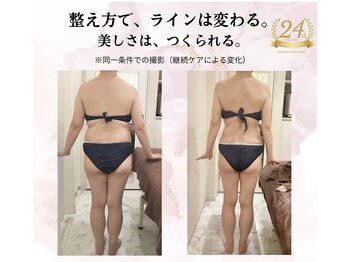 えすてさろん ケイアンドエフ(k&f)の写真/【累計口コミ1600件・創業24年実績】整え方で変わるサイズダウン。ラインから変わるボディメイク