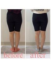 スタイルラボ高松/骨盤矯正の効果♪