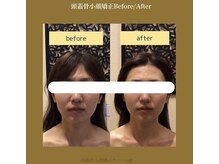 アジール 新潟市(agir)/Before/After画像