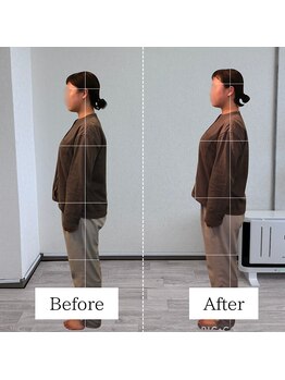 リライフ 岩槻(Re.Life)/Before/After