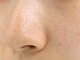 サロン ド ユニ(SALON DE UNI)の写真/お肌のお悩み何からケアすれば？！まずは毛穴洗浄×顔脱毛がおすすめ♪